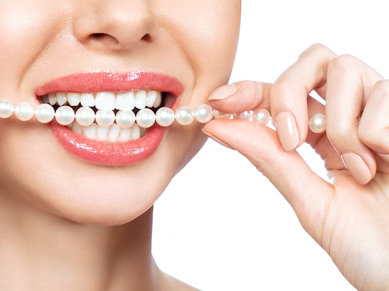 Laminate Veneers Medwork Clinic